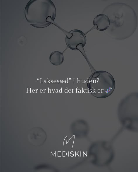 Mediskin introducerer polynukleotider som alternativ til fillers