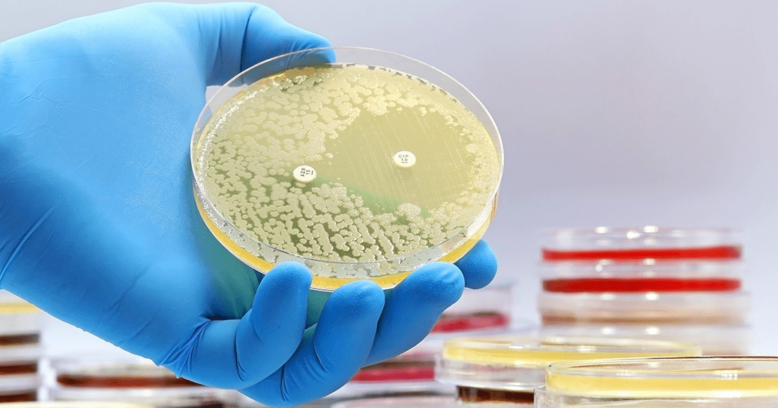 Vejlby Apotek: Skal vi frygte antibiotikaresistens?