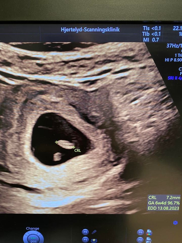 En finger på pulsen i Ikast