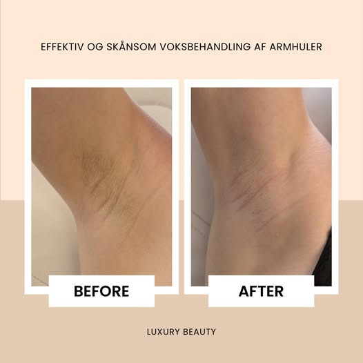 Slip for stubbe og nyd luksuriøs voksbehandling hos Luxury Beauty