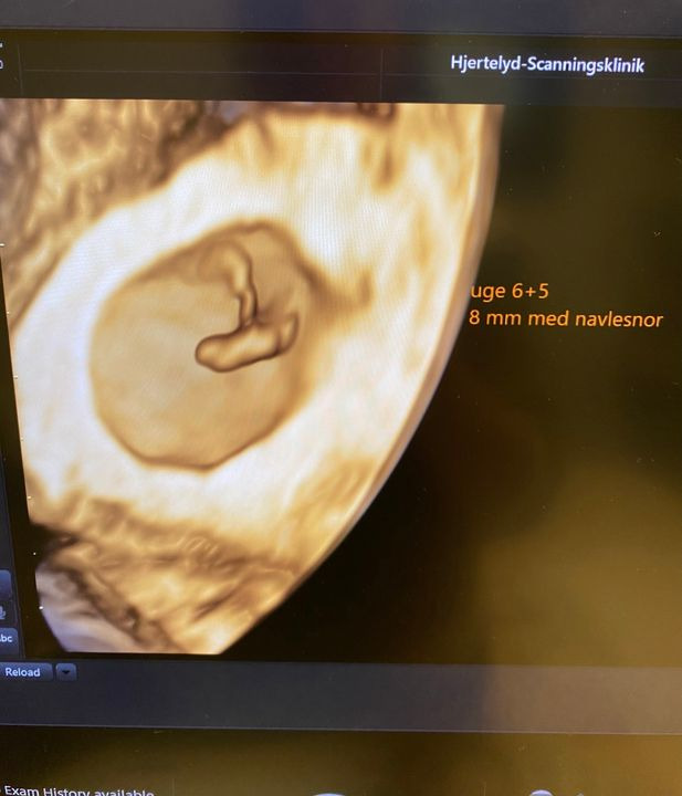 Nyt på opslagstavlen i Herning